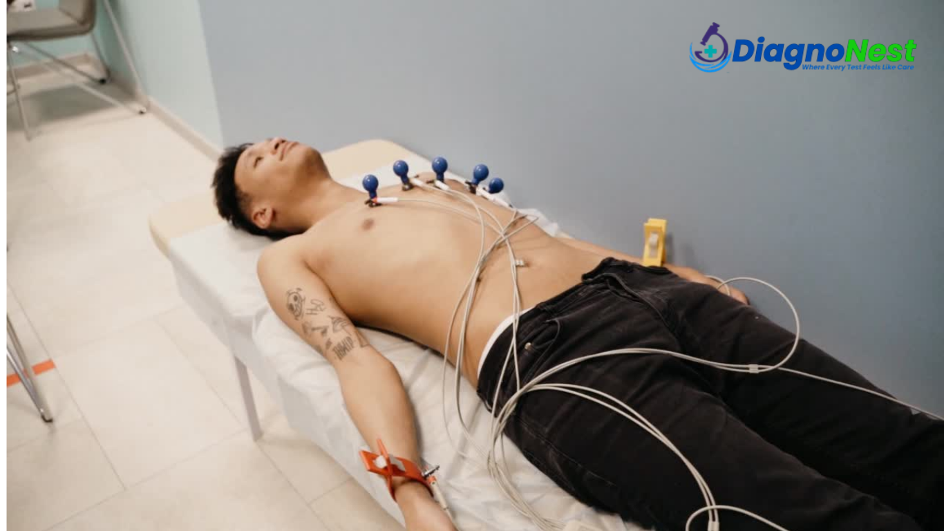 ECG at Home Services in Noida , Greater Noida and Ghaziabad